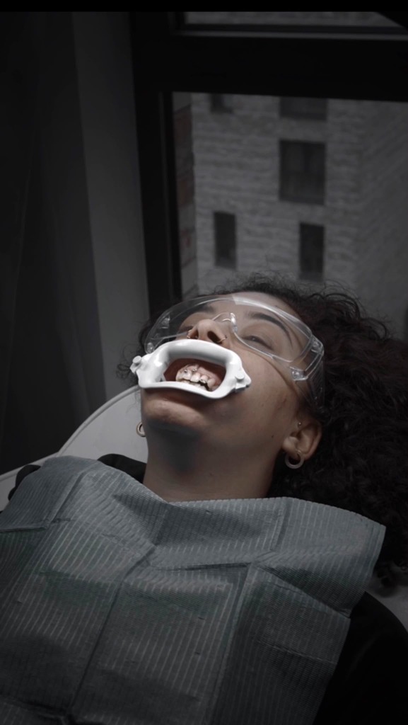 Teeth Whitening In-Clinic Treatment 4